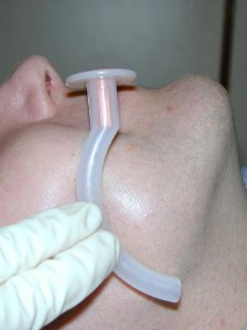 Sizing up an oropharyngeal 